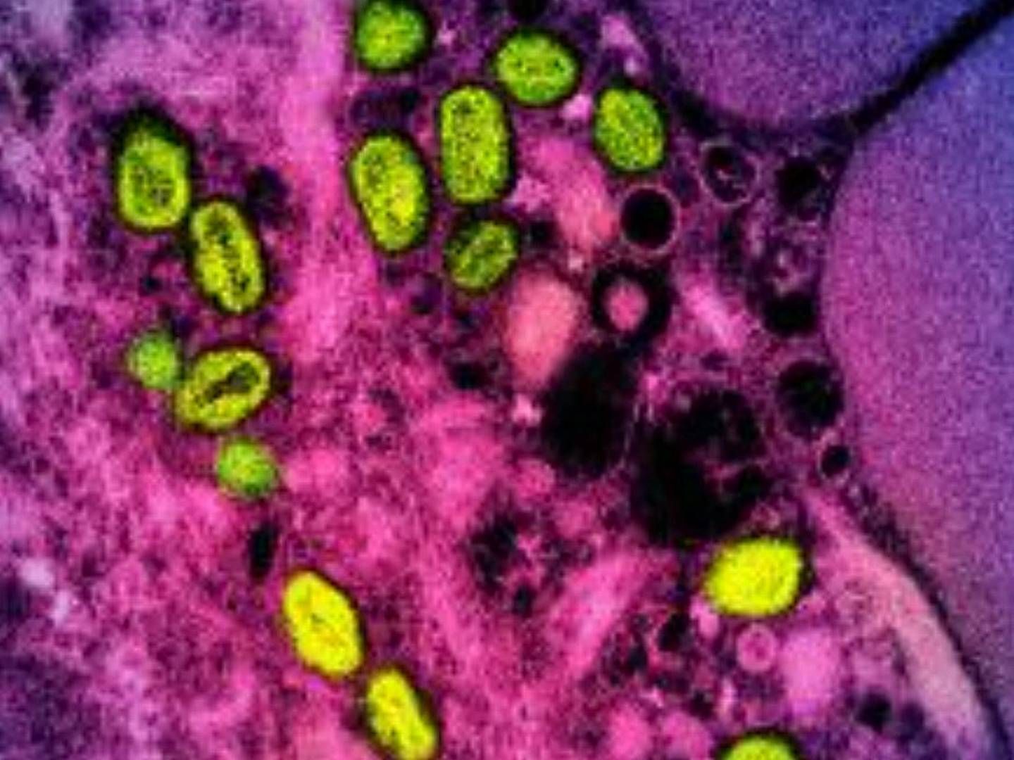 Mpox viewed through a microscope, colored | Foto: Handout
