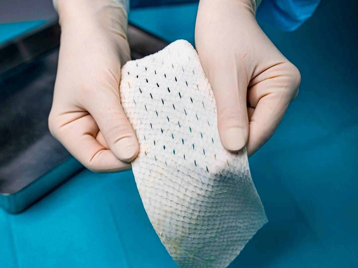 Kerecis develops fish skin products for the treatment of chronic wounds, surgical wounds, burns and other wounds that have difficulty healing. | Photo: Kerecis / Pr
