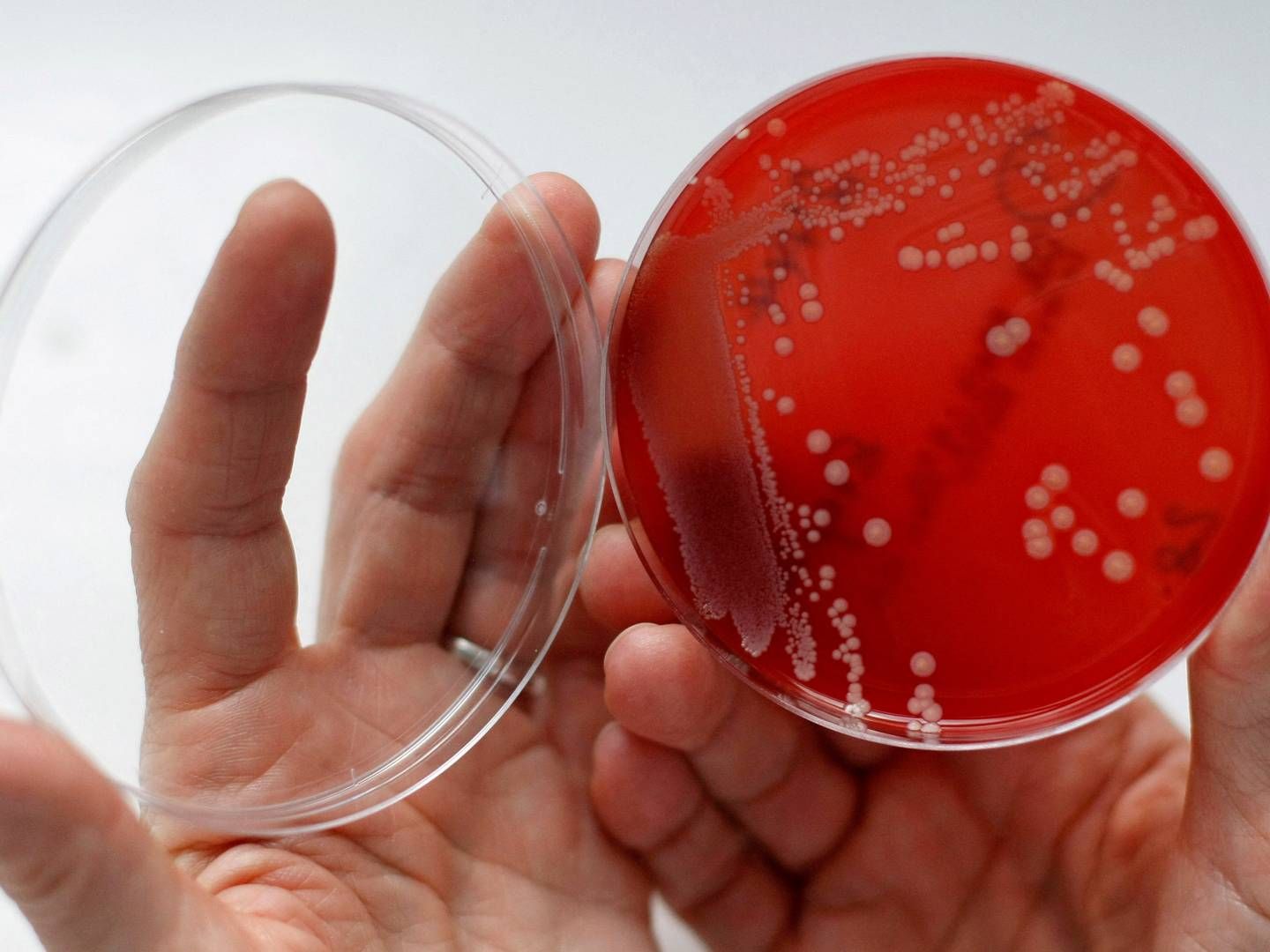 Two companies backed by Novo Holdings have come to the negotiating table and agreed on a license agreement that could lead to a new vaccine against antibiotic-resistant staphylococcus aureus (S. aureus) bacteria.