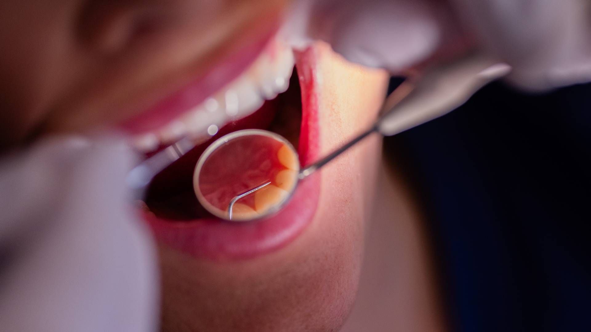 Patient beim Zahnarzt. | Foto: picture alliance/dpa | Rolf Vennenbernd