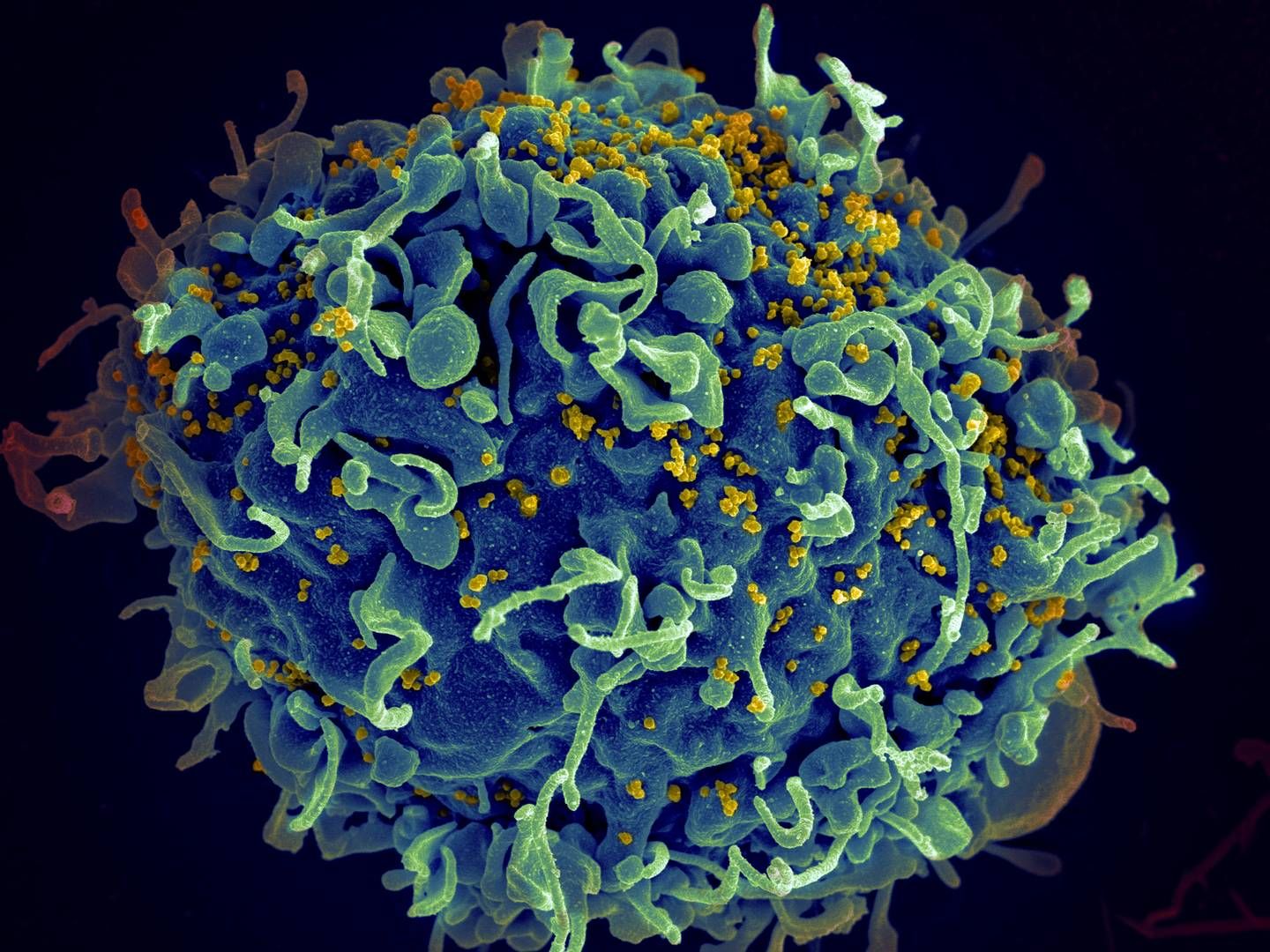 HIV-BESKYTTELSE: Mikroskop-bildet viser en menneskelig T-celle som blir angrepet av hiv-viruset. Lenacapavir fra Gilead viser nå positive resultater når det kommer til langtidsforebygging av sykdommen.