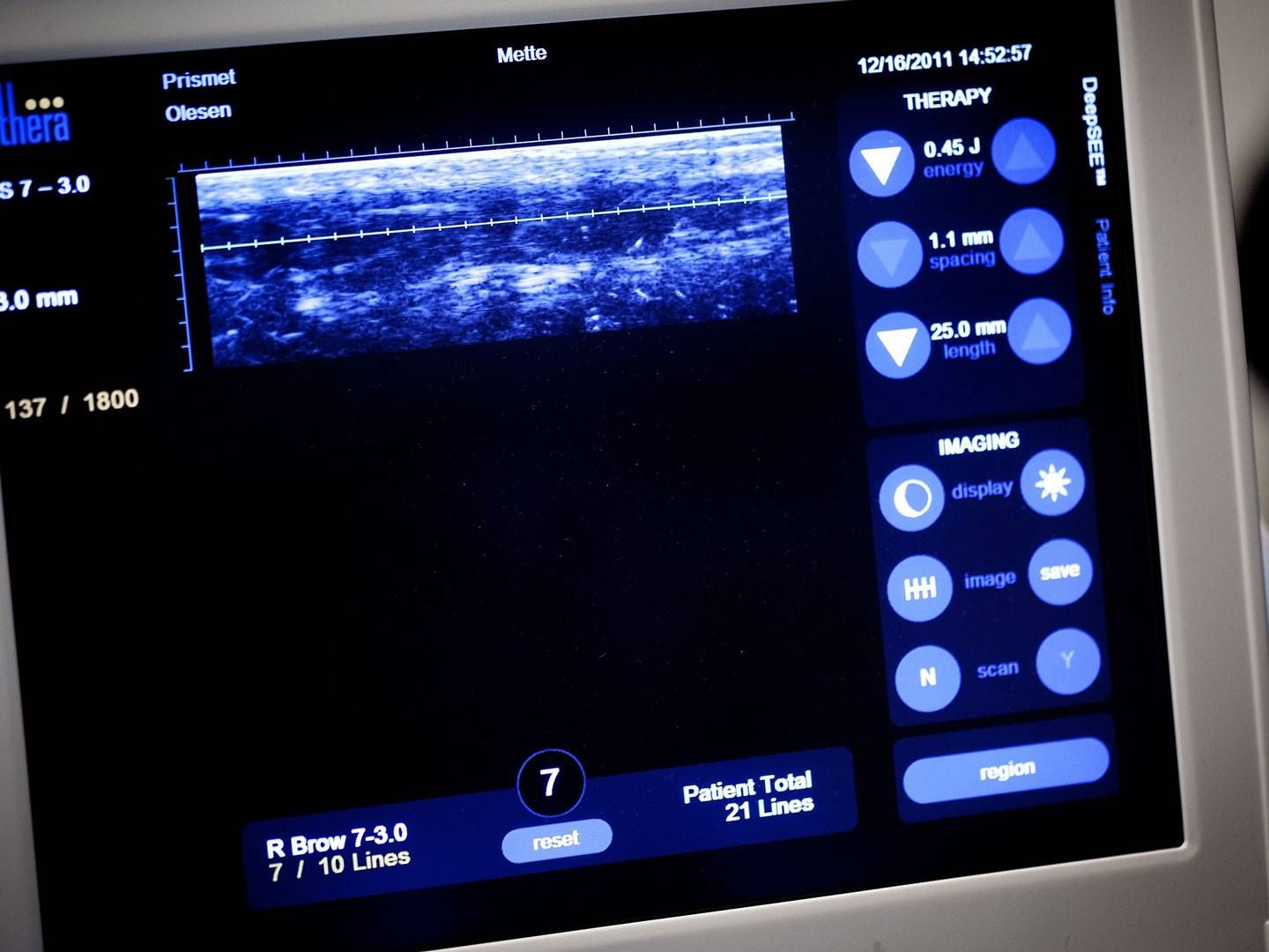 Det danske medicoselskab BK Medical, der primært sælger diagnostisk ultralydsudstyr til urologisk og kirurgisk brug, og som har hovedsæde i Herlev, skal efter al sandsynlighed have nye ejere. | Foto: /ritzau/Ole Lind