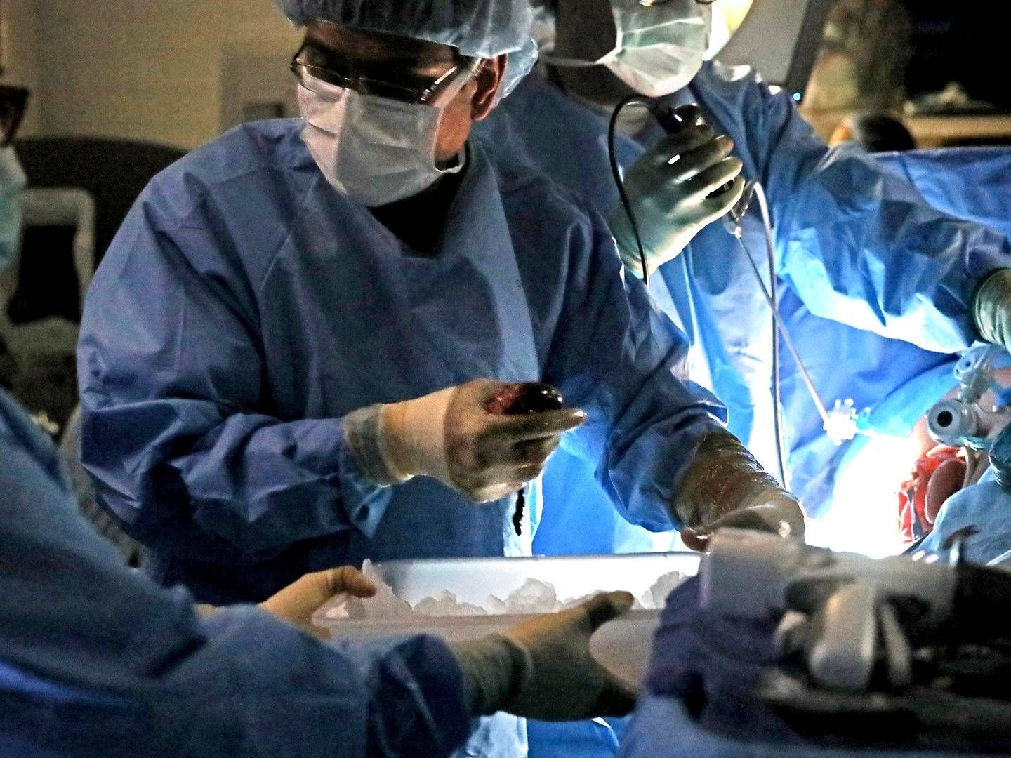 Veloxis' hovedprodukt Envarsus benyttes til at forhindre organafstødning ved nyretransplantationer, som den, der bliver foretaget her af den amerikanske kirurg Chintalapati Varma. | Foto: Laurie Skrivan / AP / Ritzau Scanpix