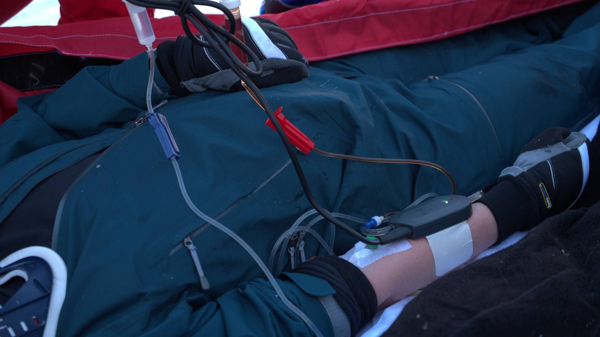 Mequs blodvarmer-system består af en varmer, et batteri og en ledning. | Foto: PR / Mequ