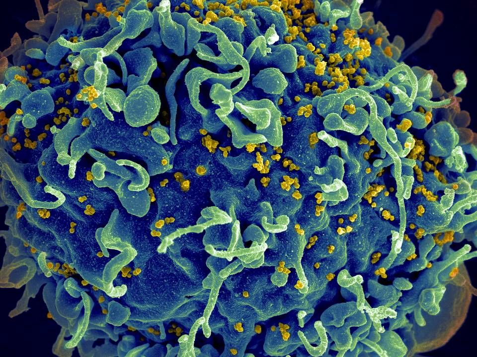Serhat Gumrukcus forskning danner ifølge Enochian Biosciences grundlag for den hiv-kur, som selskabet udvikler. Billedet her viser en immuncelle under angreb fra hiv (i gult) under et elektronmikroskop. | Foto: Elizabeth Fischer, Austin Athman Seth Pincus / AP / Ritzau Scanpix
