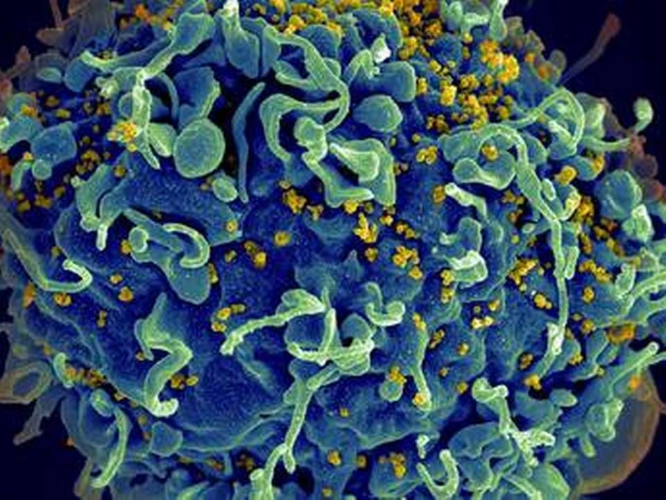 According to Enochian Biosciences, Serhat Gumrukcu's research forms the basis of a potential HIV cure. This picture shows an immune cell under attack from HIV (in yellow) under an electric microscope. | Photo: Elizabeth Fischer, Austin Athman Seth Pincus / AP / Ritzau Scanpix