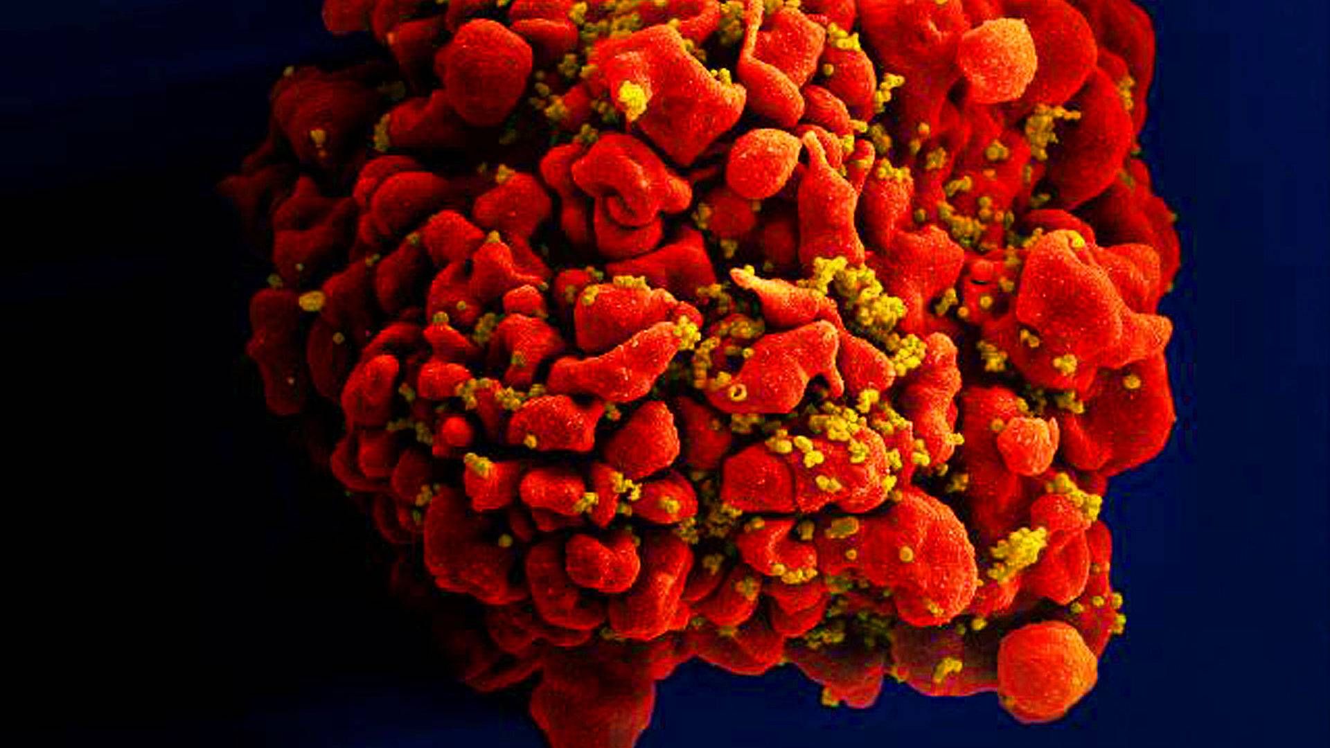 Billedet her viser en immuncelle under angreb fra hiv-virus (i gult). Billedet er taget under et elektronmikroskop af det amerikanske National Institute of Allergy and Infectious Diseases | Foto: Handout / Reuters / Ritzau Scanpix