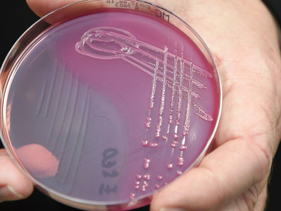 E.coli er en af de bakterier, som der er særlig stor bevågenhed omkring i forhold til antibiotikaresistens. | Foto: Ludek Perina/AP/Ritzau Scanpix