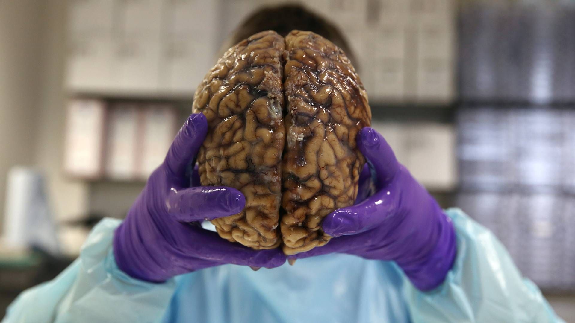 Parkinsons sygdom udvikles som resultat af en gradvis ødelæggelse af hjerneceller i et lille område i hjernen. | Foto: Neil Hall/Reuters/Ritzau Scanpix