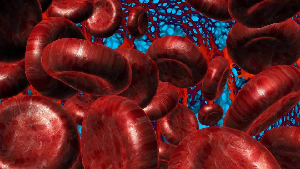 Vores blodceller er normalt runde, men i forbindelse med sygdommen seglcelleanæmi tager de form som et sejl, hvilket kan medføre smertefulde komplikationer. | Foto: Colourbox