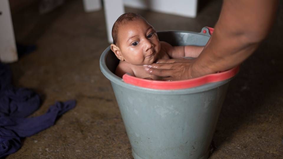 Den sjældne neurologiske udviklingsdefekt mikrocephali er ikke den eneste sygdom, som den tropiske virus Zika kan forårsage, viser et nyt studie. | Foto: Felipe Dana/AP/POLFOTO/arkiv